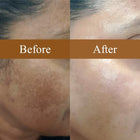 ELSUN SUNSCREEN GEL
