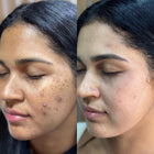 MELA E FACE SERUM